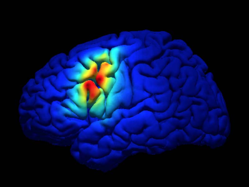 group-lab-NeuralSystems Neural Systems Lab featured photo with an activated brain.
